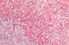 Immunohistochemistry analysis using Rabbit Anti-HSP60 Polyclonal Antibody (STPA00004). Tissue: Adrenal. Species: Human. Fixation: Formalin fixed paraffin-embedded. Primary Antibody: Rabbit Anti-HSP60 Polyclonal Antibody (STPA00004).