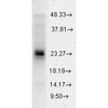Western blot analysis of Human Cervical cancer cell line (HeLa) lysate showing detection of HSP27 protein using Rabbit Anti-HSP27 Polyclonal Antibody (STPA00005). Load: 15 µgprotein. Block: 1.5% BSA. Primary Antibody: Rabbit Anti-HSP27 Polyclonal Antibody (STPA00005) at 1:2000 for 2 hours at RT. Secondary Antibody: Donkey Anti-Rabbit IgG: HRP for 1 hour at RT.