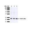 Western blot analysis of Mouse Brain, Rat Brain, and Rat Brain Membrane showing detection of 24.7kDa SOD2 (Mn) protein using Rabbit Anti-SOD2 (Mn) Polyclonal Antibody (STPA00014). Lane 1: MW Ladder. Lane 2: Mouse Brain (15 µg). Lane 3: Rat Brain (15 µg). Lane 4: Rat Brain Membrane (15 µg). Block: 5% Skim Milk powder in TBST. Primary Antibody: Rabbit Anti-SOD2 (Mn) Polyclonal Antibody (STPA00014) at 1:1000 for O/N at 4C.