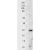 Western blot analysis of Rat Tissue lysates showing detection of SOD2 (Mn) protein using Rabbit Anti-SOD2 (Mn) Polyclonal Antibody (STPA00013). Load: 15 µgprotein. Block: 1.5% BSA for 30 minutes at RT. Primary Antibody: Rabbit Anti-SOD2 (Mn) Polyclonal Antibody (STPA00013) at 1:1000 for 2 hours at RT. Secondary Antibody: Donkey Anti-Rabbit IgG: HRP for 1 hour at RT.