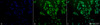 Immunocytochemistry/Immunofluorescence analysis using Rabbit Anti-Ubiquitin Polyclonal Antibody (STPA00015). Tissue: Cervical cancer cell line (HeLa). Species: Human. Fixation: 2% Formaldehyde for 20 min at RT. Primary Antibody: Rabbit Anti-Ubiquitin Polyclonal Antibody (STPA00015) at 1:200 for 12 hours at 4°C. Secondary Antibody: FITC Goat Anti-Rabbit (green) at 1:200 for 2 hours at RT.