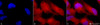 Immunocytochemistry/Immunofluorescence analysis using Rabbit Anti-Erk1/2 Polyclonal Antibody (STPA00016). Tissue: Cervical cancer cell line (HeLa). Species: Human. Fixation: 2% Formaldehyde for 20 min at RT. Primary Antibody: Rabbit Anti-Erk1/2 Polyclonal Antibody (STPA00016) at 1:100 for 12 hours at 4°C. Secondary Antibody: APC Goat Anti-Rabbit (red) at 1:200 for 2 hours at RT.