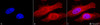 Immunocytochemistry/Immunofluorescence analysis using Rabbit Anti-Alpha B Crystallin Polyclonal Antibody (STPA00018). Tissue: Heat Shocked Cervical cancer cell line (HeLa). Species: Human. Fixation: 2% Formaldehyde for 20 min at RT. Primary Antibody: Rabbit Anti-Alpha B Crystallin Polyclonal Antibody (STPA00018) at 1:120 for 12 hours at 4°C. Secondary Antibody: APC Goat Anti-Rabbit (red) at 1:200 for 2 hours at RT.