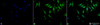 Immunocytochemistry/Immunofluorescence analysis using Rabbit Anti-Alpha B Crystallin Polyclonal Antibody (STPA00018). Tissue: Heat Shocked Cervical cancer cell line (HeLa). Species: Human. Fixation: 2% Formaldehyde for 20 min at RT. Primary Antibody: Rabbit Anti-Alpha B Crystallin Polyclonal Antibody (STPA00018) at 1:120 for 12 hours at 4°C. Secondary Antibody: FITC Goat Anti-Rabbit (green) at 1:200 for 2 hours at RT.