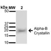 Western blot analysis of Rat Brain cell lysates showing detection of ~22 kDa Alpha B Crystallin protein using Rabbit Anti-Alpha B Crystallin Polyclonal Antibody (STPA00018). Lane 1: Molecular Weight Ladder (MW). Lane 2: Rat Brain cell lysates. Load: 15 µg. Block: 5% Skim Milk in 1X TBST. Primary Antibody: Rabbit Anti-Alpha B Crystallin Polyclonal Antibody (STPA00018) at 1:1000 for 60 min at RT.