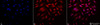 Immunocytochemistry/Immunofluorescence analysis using Rabbit Anti-Rab4 Polyclonal Antibody (STPA00019). Tissue: Heat Shocked Cervical cancer cell line (HeLa). Species: Human. Fixation: 2% Formaldehyde for 20 min at RT. Primary Antibody: Rabbit Anti-Rab4 Polyclonal Antibody (STPA00019) at 1:150 for 12 hours at 4°C. Secondary Antibody: APC Goat Anti-Rabbit (red) at 1:200 for 2 hours at RT.