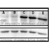Western blot analysis of Mouse Spleen lysates showing detection of Phosphoserine protein using Rabbit Anti-Phosphoserine Polyclonal Antibody (STPA00021). Primary Antibody: Rabbit Anti-Phosphoserine Polyclonal Antibody (STPA00021) at 1:1000. Bands are responsive to treatment with varying long UV wavelengths: A(0), B(50), C(200), D(400), and E (treated with 0.1µM okadaic acid).