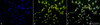 Immunocytochemistry/Immunofluorescence analysis using Rabbit Anti-Phosphothreonine Polyclonal Antibody (STPA00022). Tissue: Cervical cancer cell line (HeLa). Species: Human. Fixation: 2% Formaldehyde for 20 min at RT. Primary Antibody: Rabbit Anti-Phosphothreonine Polyclonal Antibody (STPA00022) at 1:60 for 12 hours at 4°C. Secondary Antibody: R-PE Goat Anti-Rabbit (yellow) at 1:200 for 2 hours at RT.