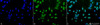 Immunocytochemistry/Immunofluorescence analysis using Rabbit Anti-Acetylated Lysine Polyclonal Antibody (STPA00023). Tissue: Heat Shocked Cervical cancer cell line (HeLa). Species: Human. Fixation: 2% Formaldehyde for 20 min at RT. Primary Antibody: Rabbit Anti-Acetylated Lysine Polyclonal Antibody (STPA00023) at 1:100 for 12 hours at 4°C. Secondary Antibody: FITC Goat Anti-Rabbit (green) at 1:200 for 2 hours at RT.