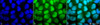 Immunocytochemistry/Immunofluorescence analysis using Rabbit Anti-Methylated Lysine Polyclonal Antibody (STPA00024). Tissue: Cervical cancer cell line (HeLa). Species: Human. Fixation: 2% Formaldehyde for 20 min at RT. Primary Antibody: Rabbit Anti-Methylated Lysine Polyclonal Antibody (STPA00024) at 1:50 for 12 hours at 4°C. Secondary Antibody: FITC Goat Anti-Rabbit (green) at 1:200 for 2 hours at RT.