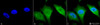 Immunocytochemistry/Immunofluorescence analysis using Rabbit Anti-Calnexin-CT Polyclonal Antibody (STPA00031). Tissue: Heat Shocked Cervical cancer cell line (HeLa). Species: Human. Fixation: 2% Formaldehyde for 20 min at RT. Primary Antibody: Rabbit Anti-Calnexin-CT Polyclonal Antibody (STPA00031) at 1:80 for 12 hours at 4°C. Secondary Antibody: FITC Goat Anti-Rabbit (green) at 1:200 for 2 hours at RT.