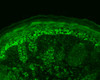 Immunohistochemistry analysis using Rabbit Anti-Cpn10 Polyclonal Antibody (STPA00036). Tissue: backskin. Species: Mouse. Fixation: Bouin's Fixative Solution. Primary Antibody: Rabbit Anti-Cpn10 Polyclonal Antibody (STPA00036) at 1:100 for 1 hour at RT. Secondary Antibody: FITC Goat Anti-Rabbit (green) at 1:50 for 1 hour at RT. Localization: Strong basal layer punctate staining in the cytoplasm, weakens as it ascends to upper epidermis.
