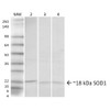 Western blot analysis of Human, Rat, Mouse Hela cells, Brain, Lung showing detection of ~18 kDa SOD1 (UbetaB) protein using Rabbit Anti-SOD1 (UbetaB) Polyclonal Antibody (STPA00041). Lane 1: Molecular Weight Ladder. Lane 2: Human HeLa Cell Lysates. Lane 3: Rat Brain. Lane 4: Mouse Lung. Load: 20 µg. Primary Antibody: Rabbit Anti-SOD1 (UbetaB) Polyclonal Antibody (STPA00041) at 1:1000. Predicted/Observed Size: ~18 kDa.