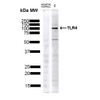 Western blot analysis of Human HeLa showing detection of ~75-80kDa TLR4 protein using Rabbit Anti-TLR4 Polyclonal Antibody (STPA00040). Lane 1: Molecular Weight Ladder. Lane 2: Human HeLa. Load: 10 µg. Block: 5% Skim Milk in 1X TBST. Primary Antibody: Rabbit Anti-TLR4 Polyclonal Antibody (STPA00040) at 1:1000 for 1 hour at RT. Secondary Antibody: Goat Anti-Rabbit IgG: HRP at 1:4000 for 1 hour at RT. Predicted/Observed Size: ~75-80kDa.