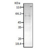 Western blot analysis of Parasite Lysates showing detection of HSP60 protein using Rabbit Anti-HSP60 Polyclonal Antibody (STPA00033). Primary Antibody: Rabbit Anti-HSP60 Polyclonal Antibody (STPA00033) at 1:1000.