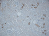 Immunohistochemistry analysis using Rabbit Anti-NCC Polyclonal Antibody (STPA00046). Tissue: kidney tissue. Species: Mouse. Fixation: paraformaldehyde-fixed paraffin-embedded. Primary Antibody: Rabbit Anti-NCC Polyclonal Antibody (STPA00046) at 1:500 for Overnight at 4°C. Secondary Antibody: Biotinylated Goat Anti-Rabbit IgG at 1:500 for 30 min at RT. Courtesy of: Brigitte Rogge.