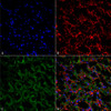 Immunohistochemistry analysis using Rabbit Anti-ENaC Polyclonal Antibody (STPA00047). Tissue: kidney tissue. Species: Rat. Fixation: Formalin Fixed Paraffin-Embedded. Primary Antibody: Rabbit Anti-ENaC Polyclonal Antibody (STPA00047) at 1:25 for 1 hour at RT. Secondary Antibody: Goat Anti-Rabbit IgG: Alexa Fluor 488. Counterstain: Actin-binding Phalloidin-Alexa Fluor 633; DAPI (blue) nuclear stain. Magnification: 63X.