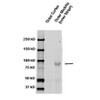 Western blot analysis of Rat kidney tissue lysates showing detection of ENaC protein using Rabbit Anti-ENaC Polyclonal Antibody (STPA00048). Primary Antibody: Rabbit Anti-ENaC Polyclonal Antibody (STPA00048) at 1:1000.