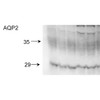 Western blot analysis of Rat kidney inner medullary homogenates showing detection of Aquaporin 2 protein using Rabbit Anti-Aquaporin 2 Polyclonal Antibody (STPA00052). Primary Antibody: Rabbit Anti-Aquaporin 2 Polyclonal Antibody (STPA00052) at 1:2000. Showing glycosylated and non-glycosylated bands.