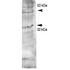 Western blot analysis of Rat kidney inner medullary homogenates showing detection of Aquaporin 4 protein using Rabbit Anti-Aquaporin 4 Polyclonal Antibody (STPA00054). Primary Antibody: Rabbit Anti-Aquaporin 4 Polyclonal Antibody (STPA00054) at 1:2000.