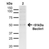 Western blot analysis of Human Cervical cancer cell line (HeLa) lysate showing detection of ~51kDa Beclin 1 protein using Rabbit Anti-Beclin 1 Polyclonal Antibody (STPA00058). Lane 1: MW Ladder. Lane 2: Human HeLa (20 µg). Load: 20 µg. Block: 5% milk + TBST for 1 hour at RT. Primary Antibody: Rabbit Anti-Beclin 1 Polyclonal Antibody (STPA00058) at 1:1000 for 1 hour at RT. Secondary Antibody: Goat Anti-Rabbit: HRP at 1:2000 for 1 hour at RT.