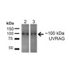 Western blot analysis of Human HeLa and HEK293T cell lysates showing detection of ~100kDa UVRAG protein using Rabbit Anti-UVRAG Polyclonal Antibody (STPA00059). Lane 1: MW Ladder. Lane 2: Human HeLa (20 µg). Lane 3: Human 293T (20 µg). Load: 20 µg. Block: 5% Skim Milk for 1 hour at RT. Primary Antibody: Rabbit Anti-UVRAG Polyclonal Antibody (STPA00059) at 1:200 for 1 hour at RT.