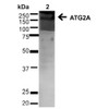Western blot analysis of Human Cervical cancer cell line (HeLa) lysate showing detection of ~212.9kDa ATG2A protein using Rabbit Anti-ATG2A Polyclonal Antibody (STPA00066). Lane 1: MW Ladder. Lane 2: Human HeLa (20 µg). Load: 20 µg. Block: 5% milk + TBST for 1 hour at RT. Primary Antibody: Rabbit Anti-ATG2A Polyclonal Antibody (STPA00066) at 1:1000 for 1 hour at RT. Secondary Antibody: Goat Anti-Rabbit: HRP at 1:2000 for 1 hour at RT.