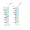Western blot analysis with anti-p53 polyclonal antibody (STPA00069) showing detection of p53 protein in HeLa whole cell lysate (Rockland W09-000-364). P53 protein has a predicted molecular weight of ~41.6 kDa but can be observed at ~53 kDa due to post translational modifications. Block: 5% skim milk. Primary Antibody: Rabbit Anti-p53 Polyclonal Antibody (STPA00069) at 1:1000 for 2 hours at RT.