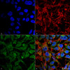 Immunocytochemistry/Immunofluorescence analysis using Rabbit Anti-BDNF Polyclonal Antibody (STPA00072). Tissue: Neuroblastoma cell line (SK-N-BE). Species: Human. Fixation: 4% Formaldehyde for 15 min at RT. Primary Antibody: Rabbit Anti-BDNF Polyclonal Antibody (STPA00072) at 1:100 for 60 min at RT. Secondary Antibody: Goat Anti-Rabbit ATTO 488 at 1:100 for 60 min at RT.