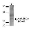 Western blot analysis of Mouse Brain showing detection of ~27.9 Kda BDNF protein using Rabbit Anti-BDNF Polyclonal Antibody (STPA00072). Lane 1: MW Ladder. Lane 2: Mouse Brain (20 µg). Load: 20 µg. Block: 5% milk + TBST for 1 hour at RT. Primary Antibody: Rabbit Anti-BDNF Polyclonal Antibody (STPA00072) at 1:1000 for 1 hour at RT. Secondary Antibody: Goat Anti-Rabbit: HRP at 1:2000 for 1 hour at RT.