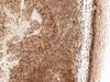 Immunohistochemistry analysis using Rabbit Anti-CCR2 Polyclonal Antibody (STPA00073). Tissue: Tonsil. Species: Human. Fixation: Formalin Fixed Paraffin-Embedded. Primary Antibody: Rabbit Anti-CCR2 Polyclonal Antibody (STPA00073) at 1:50 for 30 min at RT. Counterstain: Hematoxylin. Magnification: 10X. HRP-DAB Detection.