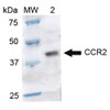 Western blot analysis of Rat Brain cell lysates showing detection of ~41.9 kDa CCR2 protein using Rabbit Anti-CCR2 Polyclonal Antibody (STPA00073). Lane 1: Molecular Weight Ladder (MW). Lane 2: Rat Brain cell lysates. Load: 15 µg. Block: 5% Skim Milk in 1X TBST. Primary Antibody: Rabbit Anti-CCR2 Polyclonal Antibody (STPA00073) at 1:1000 for 2 hours at RT. Secondary Antibody: Goat Anti-Rabbit IgG: HRP at 1:1000 for 60 min at RT.