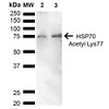 Western blot analysis of Human Cervical cancer cell line (HeLa) lysate showing detection of ~70 kDa HSP70 Acetyl Lys77 protein using Rabbit Anti-HSP70 Acetyl Lys77 Polyclonal Antibody (STPA00079). Lane 1: Molecular Weight Ladder (MW). Lane 2: Cervical Cancer cell line (HeLa) lysate. Lane 3: H2O2 Cervical Cancer cell line (HeLa) lysate. Load: 10 µg. Block: 5% Skim Milk in 1X TBST.
