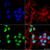 Immunocytochemistry/Immunofluorescence analysis using Rabbit Anti-Choline Acetyltransferase Polyclonal Antibody (STPA00074). Tissue: Neuroblastoma cell line (SK-N-BE). Species: Human. Fixation: 4% Formaldehyde for 15 min at RT. Primary Antibody: Rabbit Anti-Choline Acetyltransferase Polyclonal Antibody (STPA00074) at 1:100 for 60 min at RT. Secondary Antibody: Goat Anti-Rabbit ATTO 488 at 1:100 for 60 min at RT.