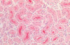 Immunohistochemistry analysis using Rabbit Anti-Tau Polyclonal Antibody (STPA00087). Tissue: Kidney. Species: Human. Fixation: Formalin fixed paraffin-embedded. Primary Antibody: Rabbit Anti-Tau Polyclonal Antibody (STPA00087).