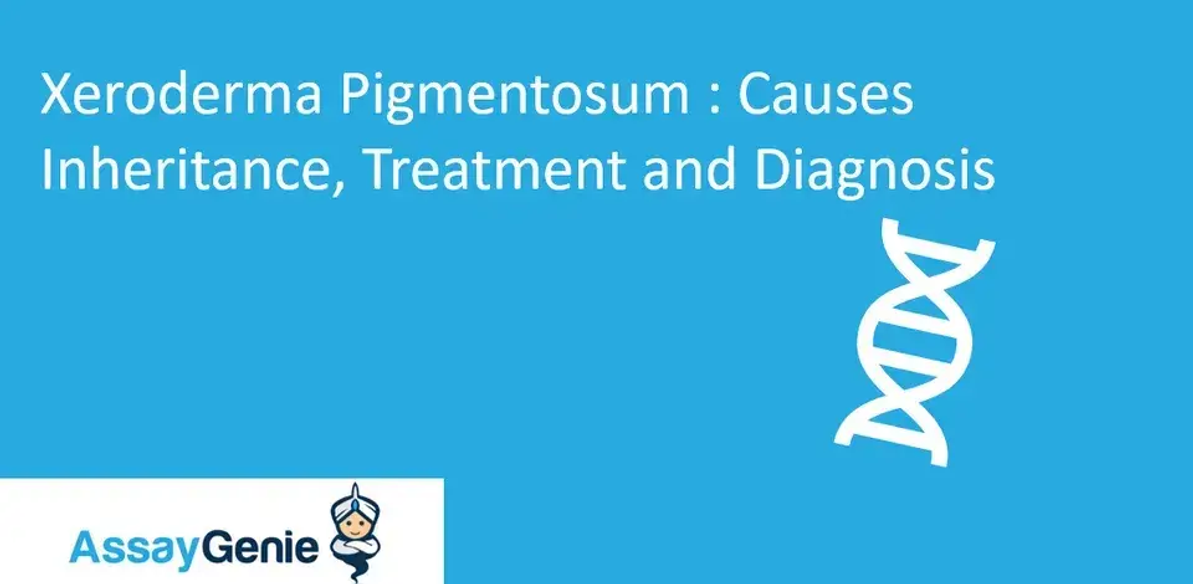 Xeroderma pigmentosum: Ursachen, Vererbung, Behandlung und Diagnose