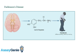 Entschlüsselung der Parkinson-Krankheit: Einblicke in eine komplexe neurologische Störung