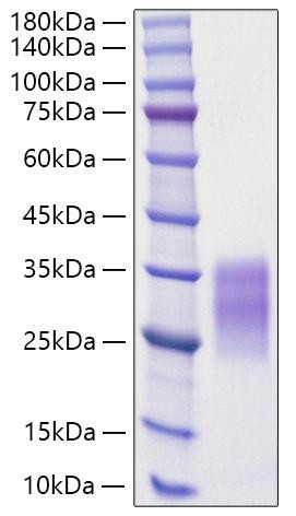 Recombinant Rat c-Kit ligand/KITLG/SCF Protein (RPCB1811)