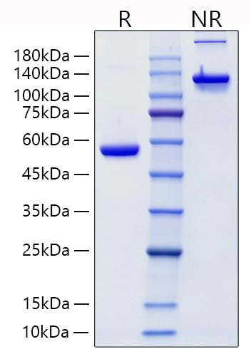 Recombinant Human Lipocalin-2/NGAL/LCN2 Protein (RPCB1830)
