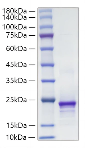 Recombinant Mouse FGF-10 Protein (RPCB1866)