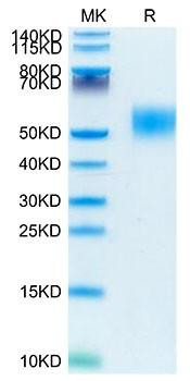 Recombinant Mouse CSF2RA/GM-CSF R alpha/CD116 Protein (RPCB1948)