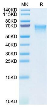 Recombinant Human MADCAM1 Protein (RPCB1982)