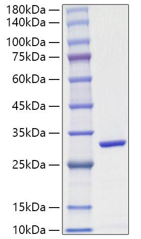 Recombinant Schistosoma japonicum GST Protein (RPCB1987)