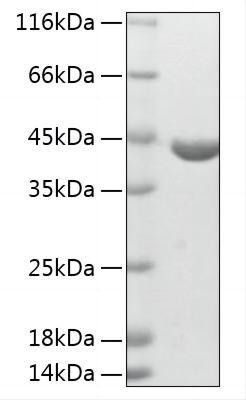 Recombinant Human ABHD4 Protein (RPCB2035)