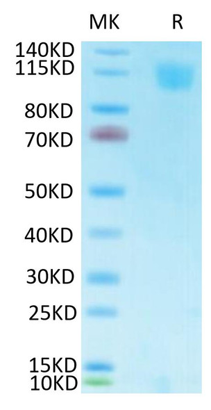 Biotinylated Recombinant SARS-CoV Spike S1 Protein (RPCB2149)