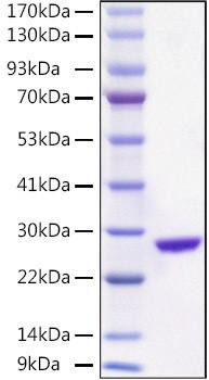 Recombinant Aequorea victoria EGFP Protein (RPCB2168)