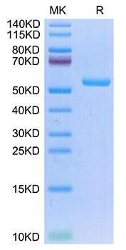 Recombinant Human NY-ESO-1 (HLA-A*02:01) Protein (RPCB2178)