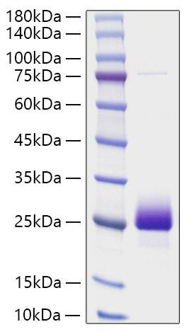 Recombinant Human NBL1 Protein (RPCB2186)