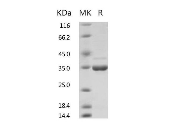 2019-nCoV Methyltransferase Recombinant Protein (RPES0058)