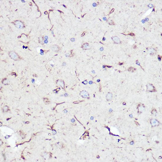 Anti-GFAP Antibody (CAB0237)
